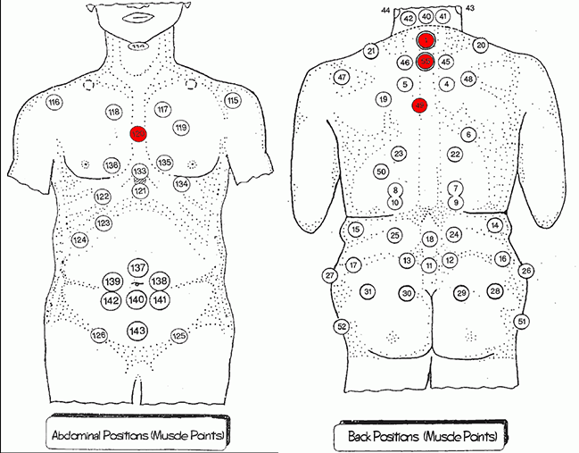 AutoimmuneHijamaPoints | Hijama Points