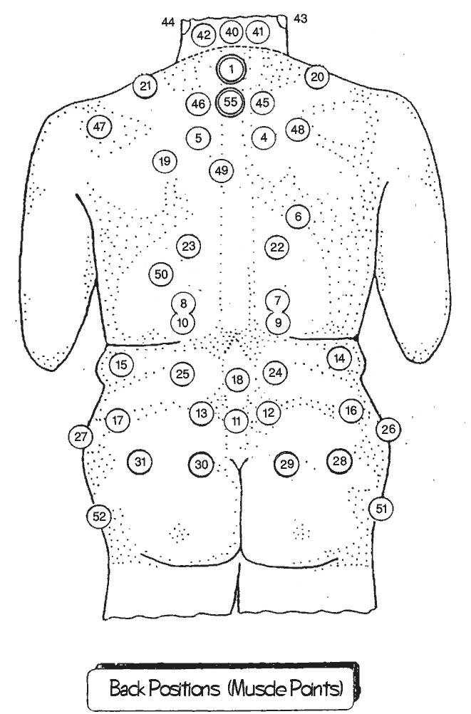 HIjama Points on the back