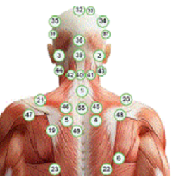 Hijama Points and Cupping Points for Maximum Beneift