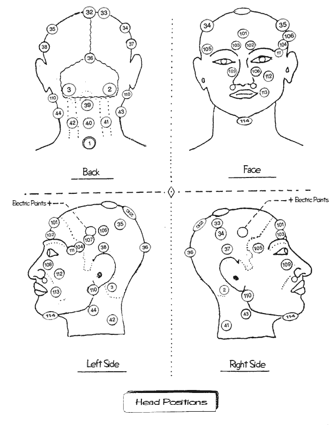 Four images of the face showing the Hijama Points