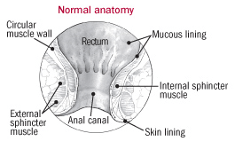Part of the body / function involved Anal Fistula - diagram of the different structures involved that hijama trys to holistically support