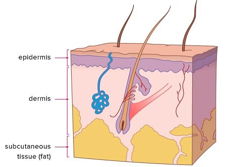 Shows the skin and below the skin where Cellulite is stored in the body.