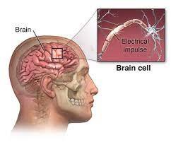 Picture of the brain and magnified image of an electrical impulse on a brain cell to show how this can create the epilepsy