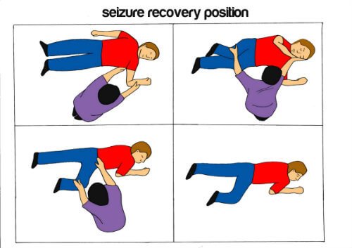 Four Different Recovery Positions shown to place a person in if they are going through a Convulsion / Fit