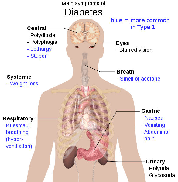 Effect and symptoms which occur with Diabetes Type 2