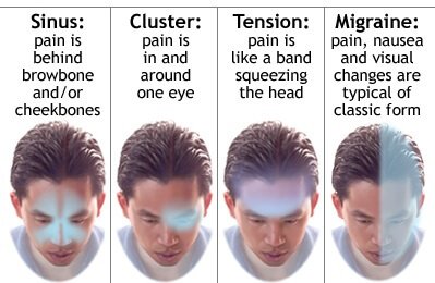 Shows four Effect and symptoms which occur with Headaches - Sinus, cluster, tension, migraine 