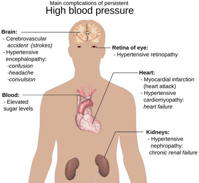 Part of the body / function which are effected by High Blood Pressure - Brain, Retina of the eye, heart, kidneys