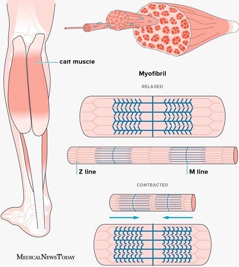 Illustration of the leg and the different muscles which can spams within it. Shows detailed structure of muscle tissue within the calf - myofibril - and how it contracts on the Z line / M Line and relaxes 