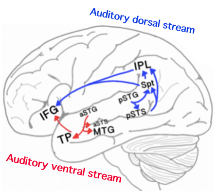Shows a side view of the brain and the various areas involved in the auditory system which may contribute towards mutism - auditory dorsal stream auditory ventral stream