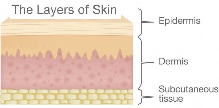 Cross section of the different layer so skin related to the Skin Diseases - Epidermis, dermis, subcutaneous tissue.