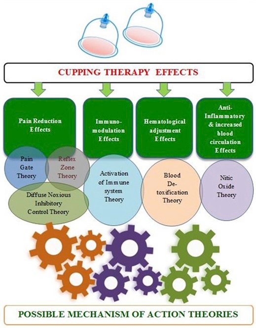 Cupping Therapy Effects Shows effect of cupping therapy broken in four areas 1) Pain reduction 2) Immune system 3) Blood System 4) Anti Inflammatory