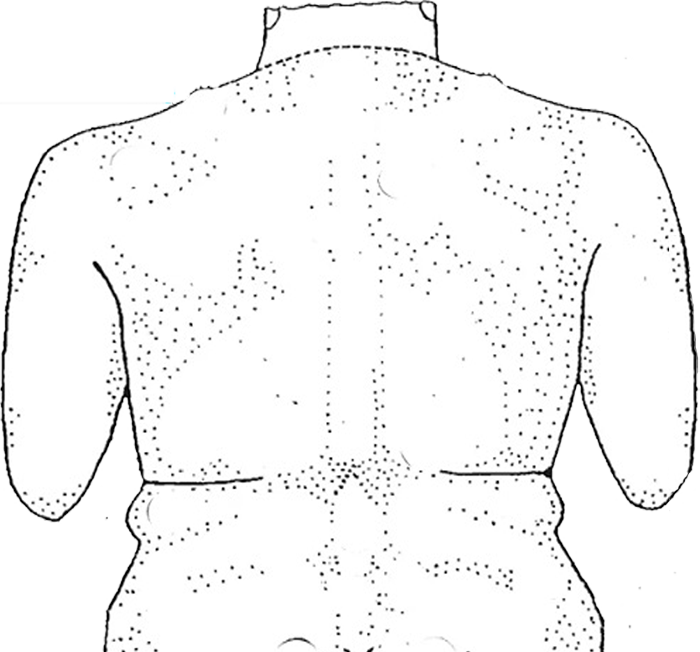 Unclothed upper body showing person back